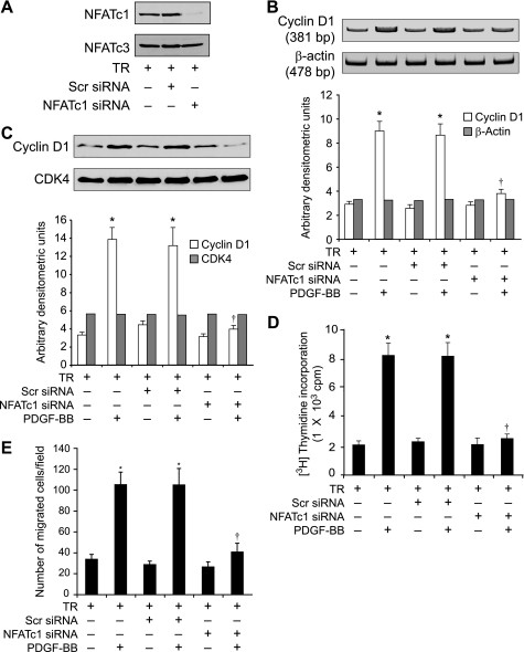 NFATC1 Antibody in Western Blot (WB)