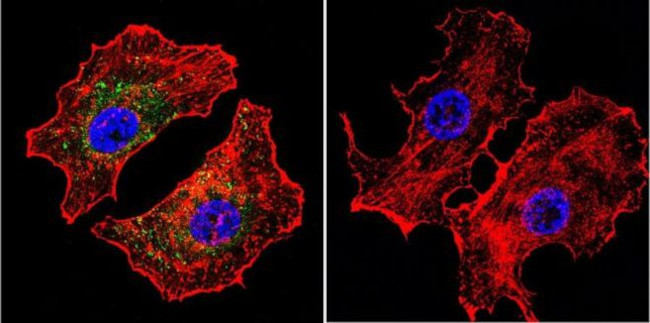 NFATC2 Antibody in Immunocytochemistry (ICC/IF)