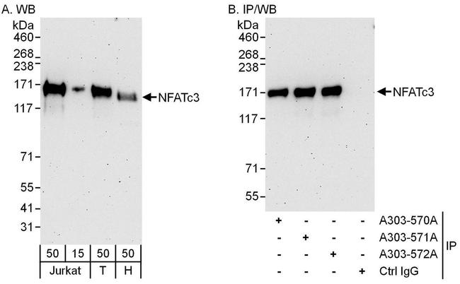 NFATc3 Antibody in Western Blot (WB)