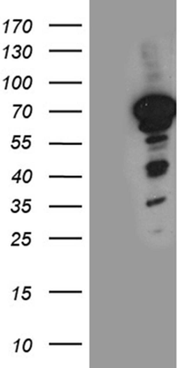 NFIA Antibody in Western Blot (WB)