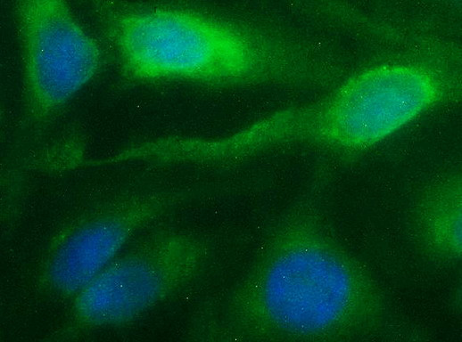 NFKBIA Antibody in Immunocytochemistry (ICC/IF)