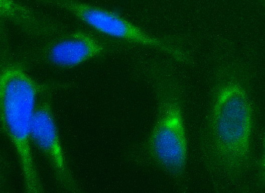 NFKBIA Antibody in Immunocytochemistry (ICC/IF)