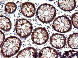 NFKBIA Antibody in Immunohistochemistry (Paraffin) (IHC (P))