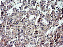 NFKBIA Antibody in Immunohistochemistry (Paraffin) (IHC (P))