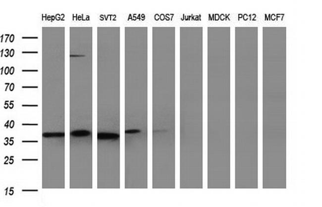 NFKBIA Antibody in Western Blot (WB)