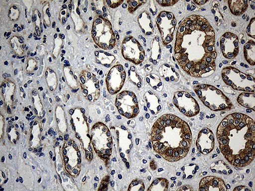 NFKBIE Antibody in Immunohistochemistry (Paraffin) (IHC (P))