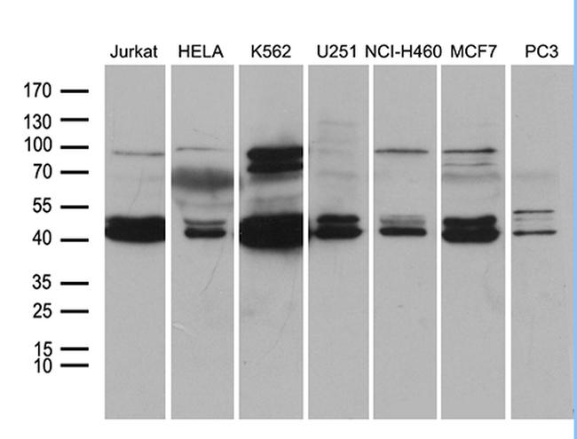 NFKBIE Antibody in Western Blot (WB)