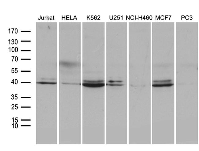 NFKBIE Antibody in Western Blot (WB)