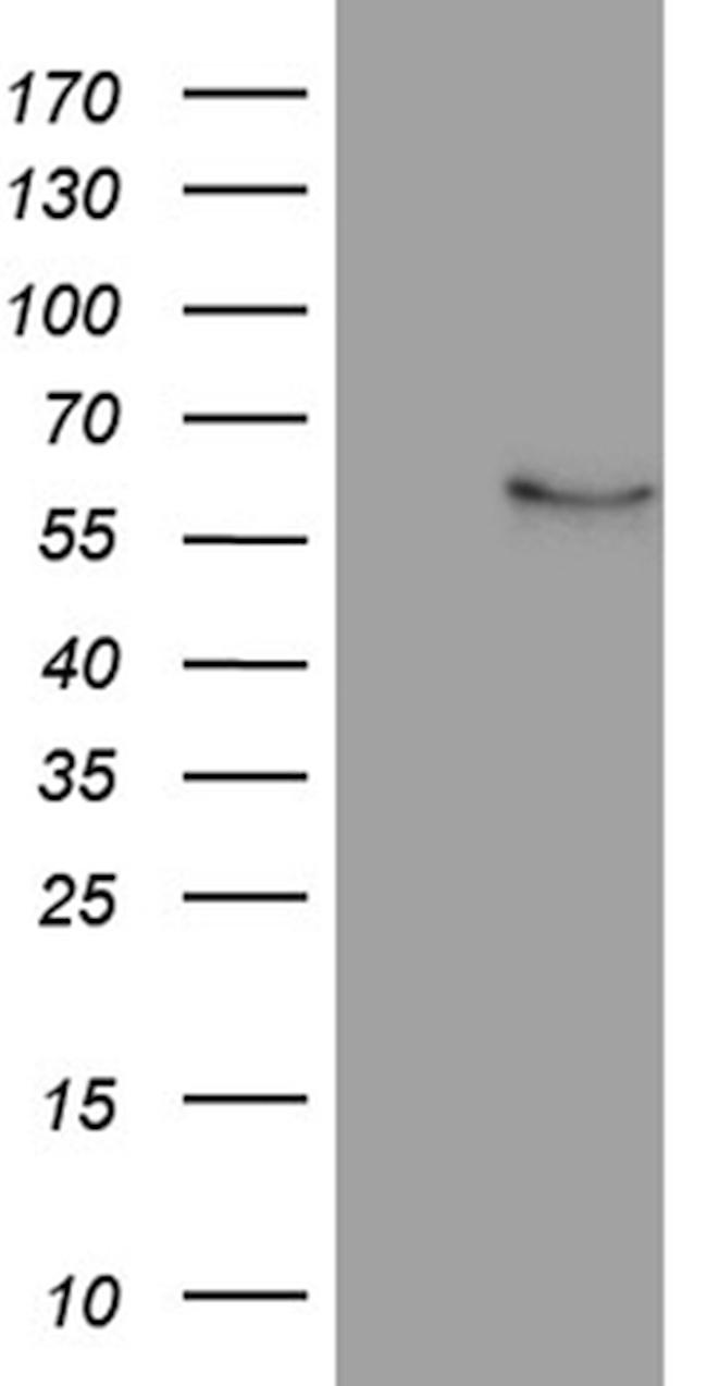 NFKBIE Antibody in Western Blot (WB)