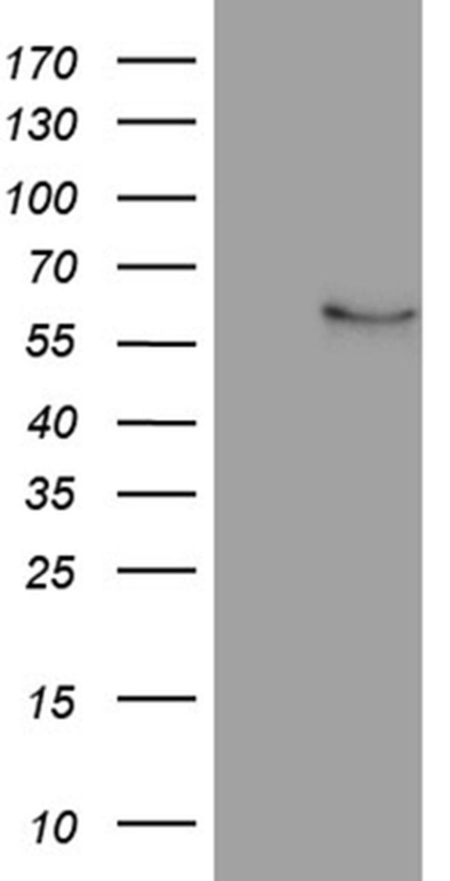 NFKBIE Antibody in Western Blot (WB)