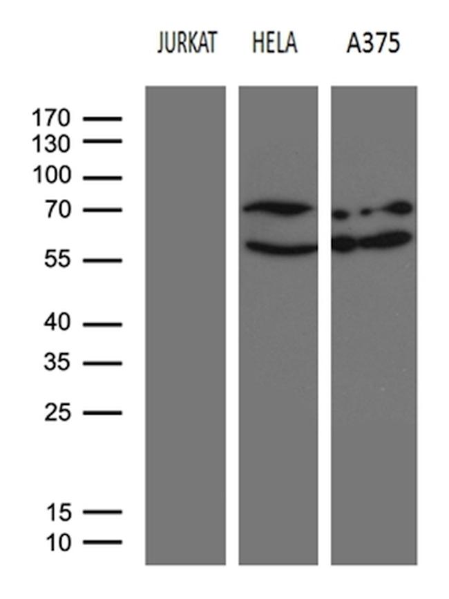 NFKBIE Antibody in Western Blot (WB)