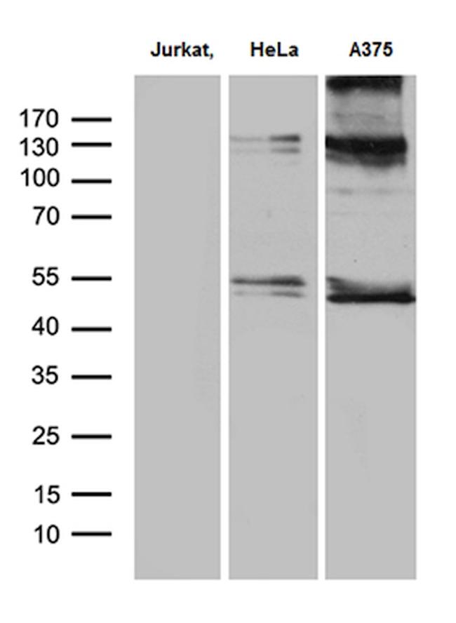 NFKBIE Antibody in Western Blot (WB)