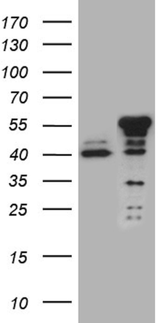 NFKBIE Antibody in Western Blot (WB)