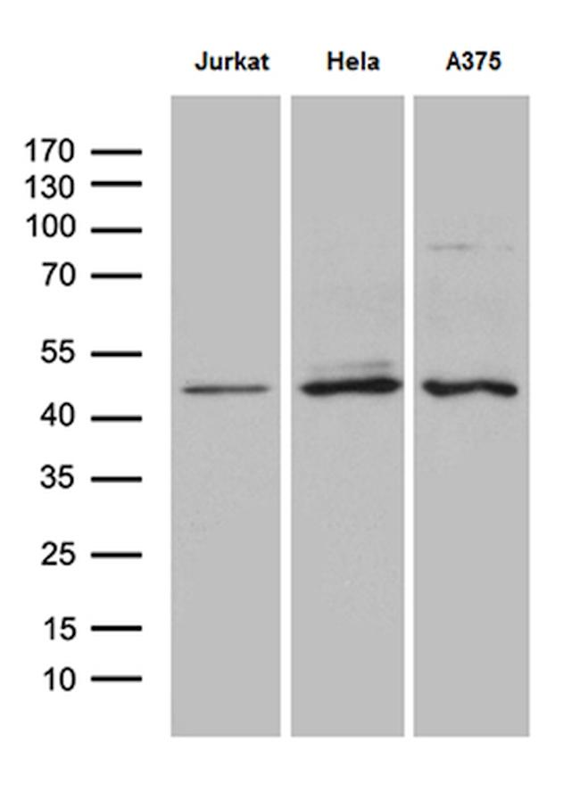 NFKBIE Antibody in Western Blot (WB)
