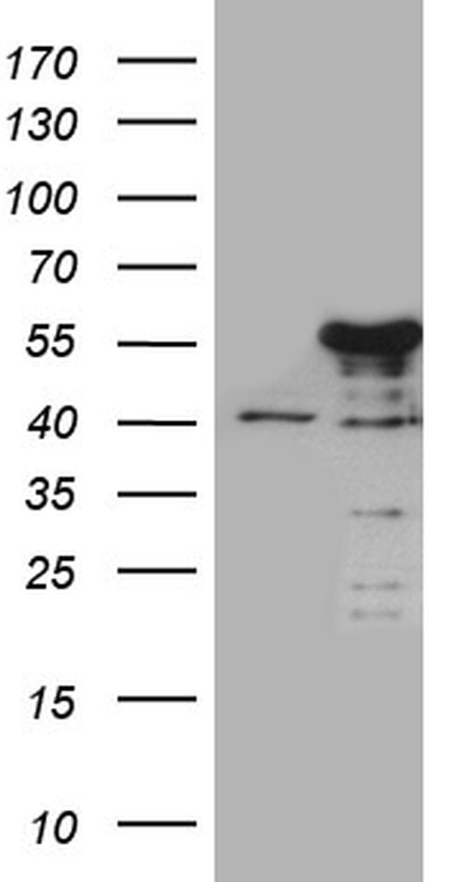 NFKBIE Antibody in Western Blot (WB)