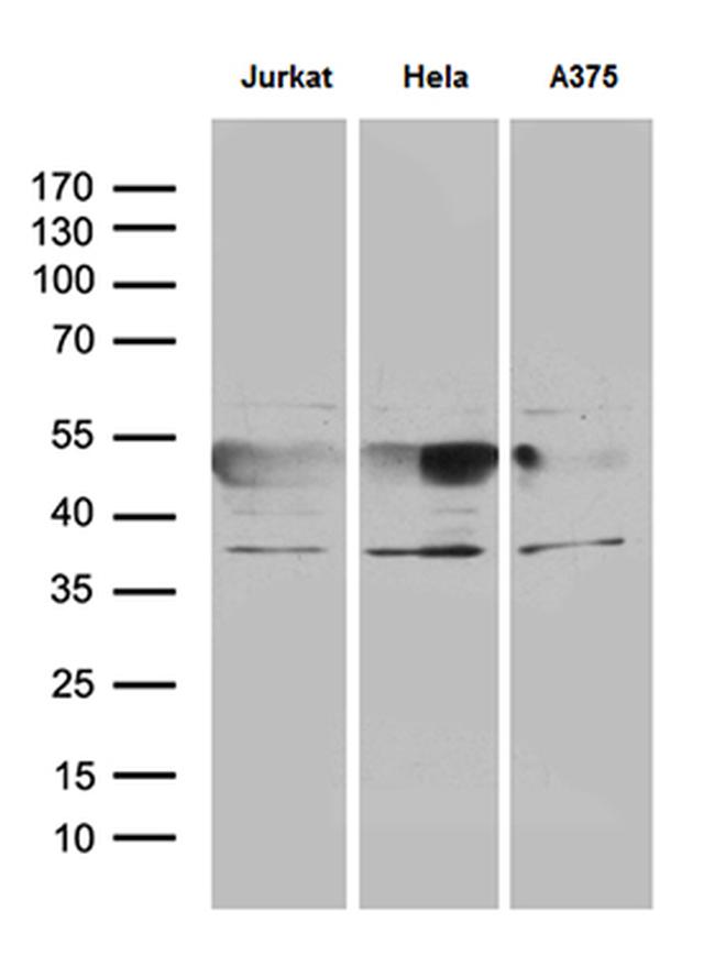 NFKBIE Antibody in Western Blot (WB)