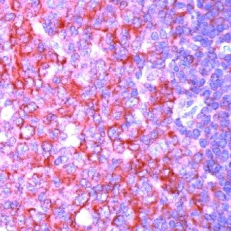 NFkB p50/p105 Antibody in Immunohistochemistry (IHC)