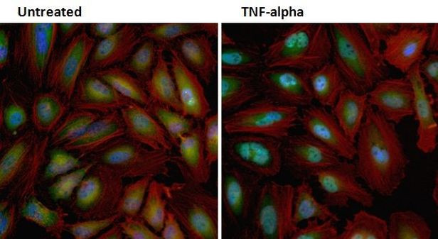 NFkB p65 Antibody in Immunocytochemistry (ICC/IF)