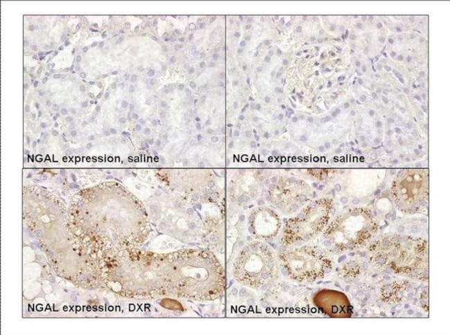 NGAL Antibody in Immunohistochemistry (Paraffin) (IHC (P))