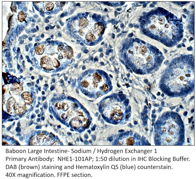 Sodium/Hydrogen Exchanger 1 Antibody in Immunohistochemistry (IHC)