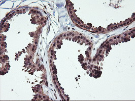 NHEJ1 Antibody in Immunohistochemistry (Paraffin) (IHC (P))