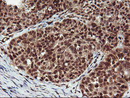 NHEJ1 Antibody in Immunohistochemistry (Paraffin) (IHC (P))