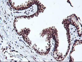 NHEJ1 Antibody in Immunohistochemistry (Paraffin) (IHC (P))