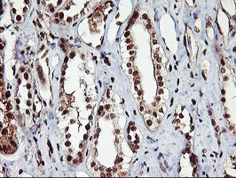 NHEJ1 Antibody in Immunohistochemistry (Paraffin) (IHC (P))