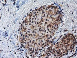 NHEJ1 Antibody in Immunohistochemistry (Paraffin) (IHC (P))