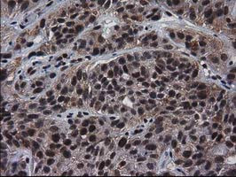 NHEJ1 Antibody in Immunohistochemistry (Paraffin) (IHC (P))