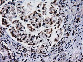 NHEJ1 Antibody in Immunohistochemistry (Paraffin) (IHC (P))