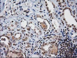 NHEJ1 Antibody in Immunohistochemistry (Paraffin) (IHC (P))