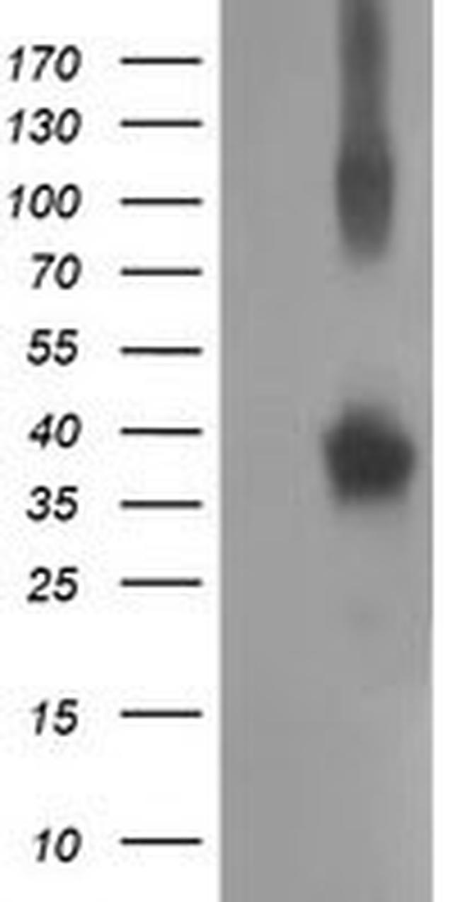 NHEJ1 Antibody in Western Blot (WB)