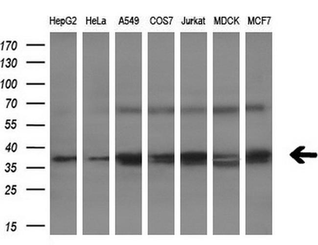 NHEJ1 Antibody in Western Blot (WB)