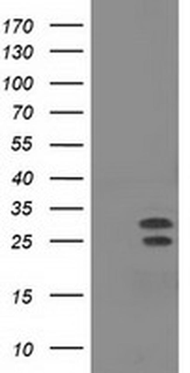 NHEJ1 Antibody in Western Blot (WB)