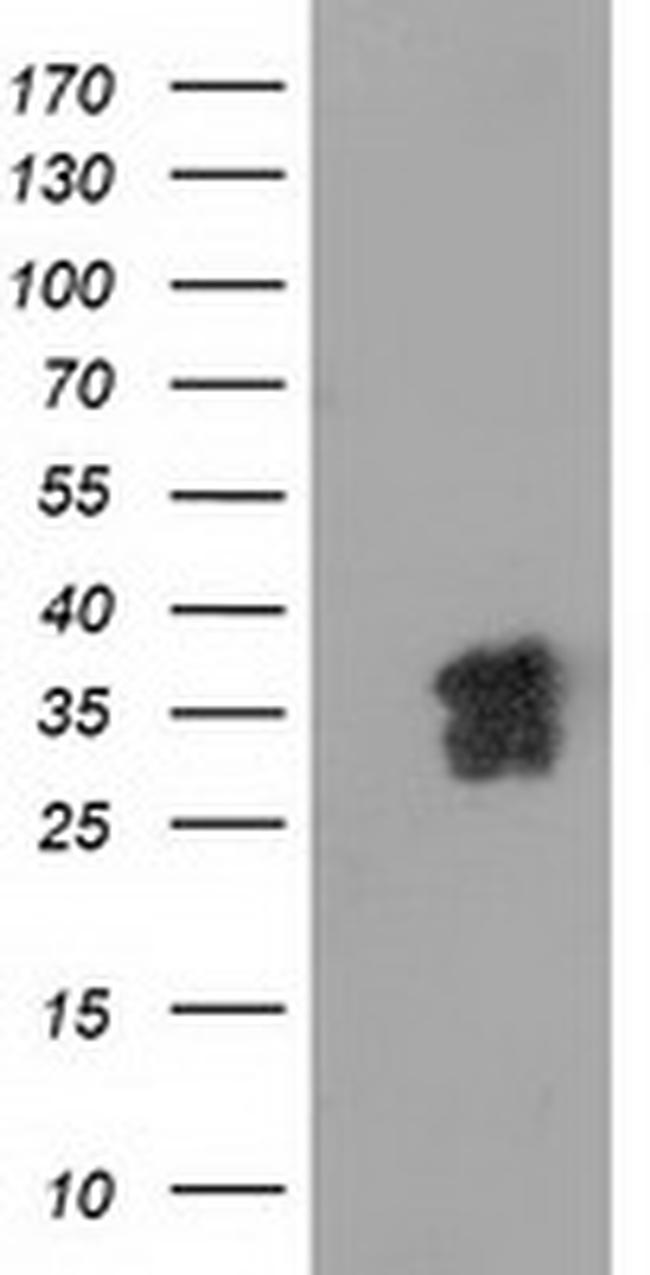 NHEJ1 Antibody in Western Blot (WB)