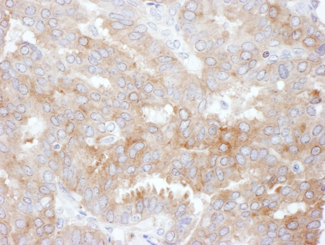 NHERF1 Antibody in Immunohistochemistry (IHC)