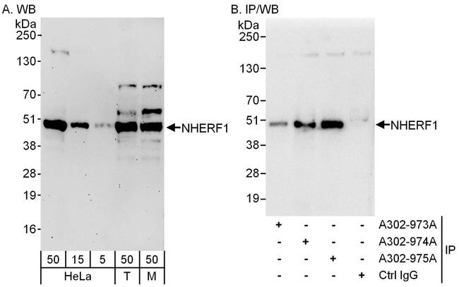 NHERF1 Antibody in Western Blot (WB)