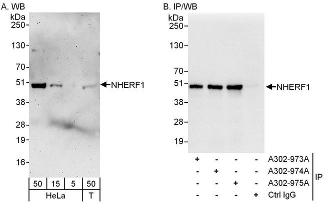 NHERF1 Antibody in Western Blot (WB)