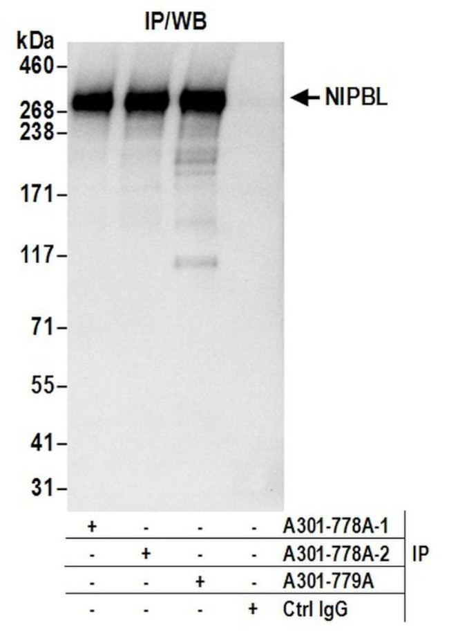 NIPBL Antibody in Immunoprecipitation (IP)