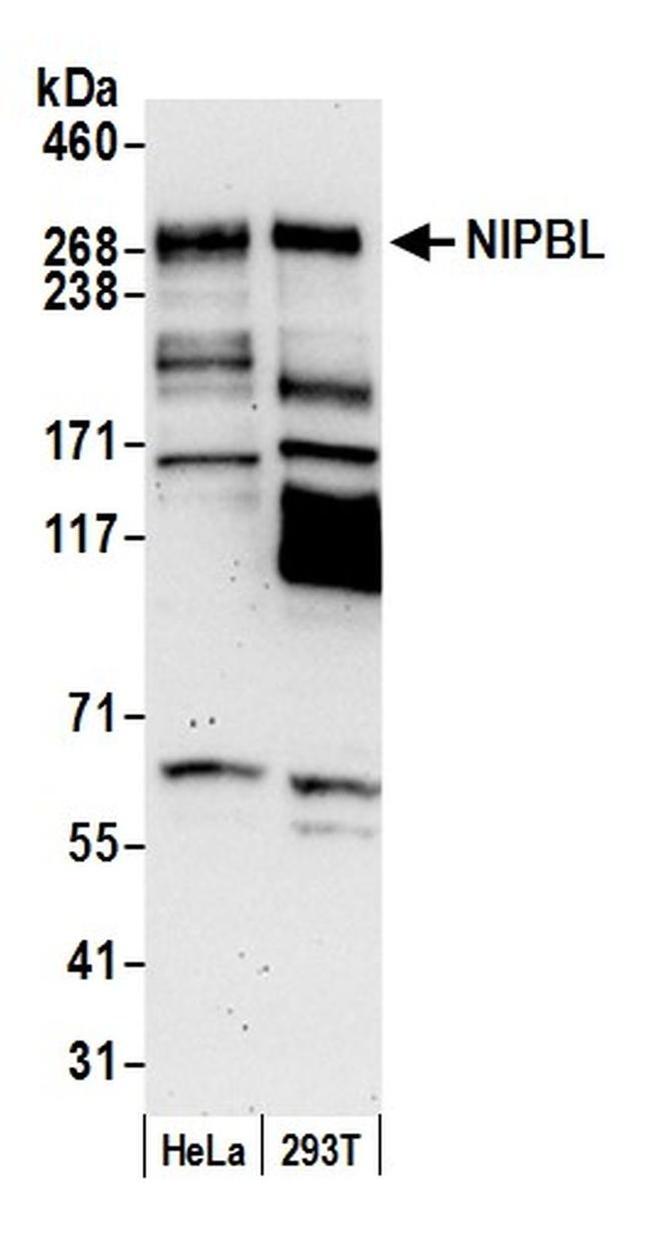 NIPBL Antibody in Western Blot (WB)