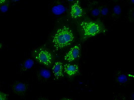 NIT1 Antibody in Immunocytochemistry (ICC/IF)