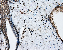 NIT2 Antibody in Immunohistochemistry (Paraffin) (IHC (P))