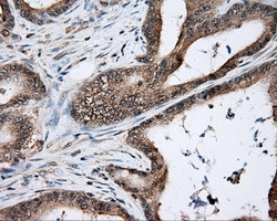 NIT2 Antibody in Immunohistochemistry (Paraffin) (IHC (P))