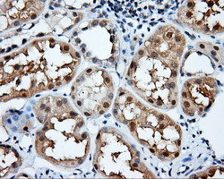 NIT2 Antibody in Immunohistochemistry (Paraffin) (IHC (P))