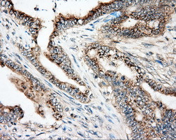 NIT2 Antibody in Immunohistochemistry (Paraffin) (IHC (P))