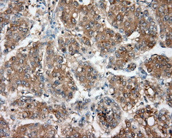 NIT2 Antibody in Immunohistochemistry (Paraffin) (IHC (P))