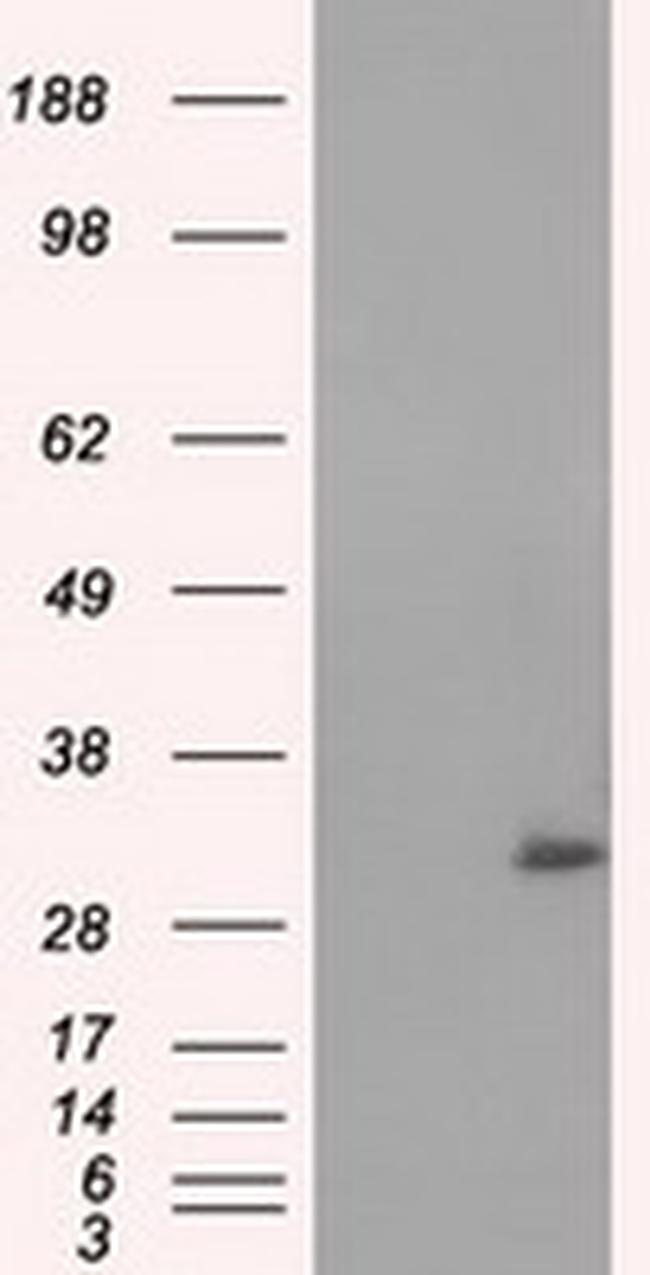 NIT2 Antibody in Western Blot (WB)