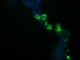 NKIRAS1 Antibody in Immunocytochemistry (ICC/IF)