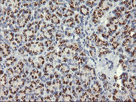 NKIRAS1 Antibody in Immunohistochemistry (Paraffin) (IHC (P))